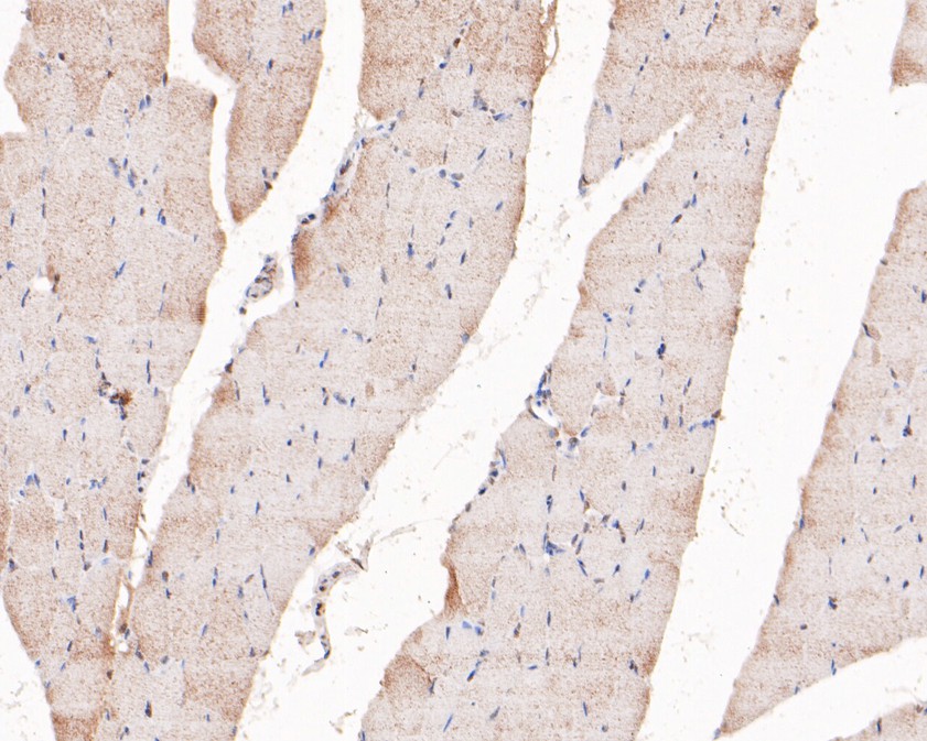 Immunohistochemical analysis of paraffin-embedded rat skeletal muscle tissue using anti-PIP5K1A antibody. The section was pre-treated using heat mediated antigen retrieval with sodium citrate buffer (pH 6.0) for 20 minutes. The tissues were blocked in 5% BSA for 30 minutes at room temperature, washed with ddH2O and PBS, and then probed with the primary antibody (HA500201, 1/400)  for 30 minutes at room temperature. The detection was performed using an HRP conjugated compact polymer system. DAB was used as the chromogen. Tissues were counterstained with hematoxylin and mounted with DPX.
