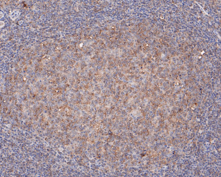 Immunohistochemical analysis of paraffin-embedded human tonsil tissue using anti-PIP5K1A antibody. The section was pre-treated using heat mediated antigen retrieval with sodium citrate buffer (pH 6.0) for 20 minutes. The tissues were blocked in 5% BSA for 30 minutes at room temperature, washed with ddH2O and PBS, and then probed with the primary antibody (HA500201, 1/100)  for 30 minutes at room temperature. The detection was performed using an HRP conjugated compact polymer system. DAB was used as the chromogen. Tissues were counterstained with hematoxylin and mounted with DPX.