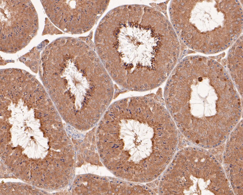 Immunohistochemical analysis of paraffin-embedded mouse testis tissue using anti-PIP5K1A antibody. The section was pre-treated using heat mediated antigen retrieval with sodium citrate buffer (pH 6.0) for 20 minutes. The tissues were blocked in 5% BSA for 30 minutes at room temperature, washed with ddH2O and PBS, and then probed with the primary antibody (HA500201, 1/100)  for 30 minutes at room temperature. The detection was performed using an HRP conjugated compact polymer system. DAB was used as the chromogen. Tissues were counterstained with hematoxylin and mounted with DPX.