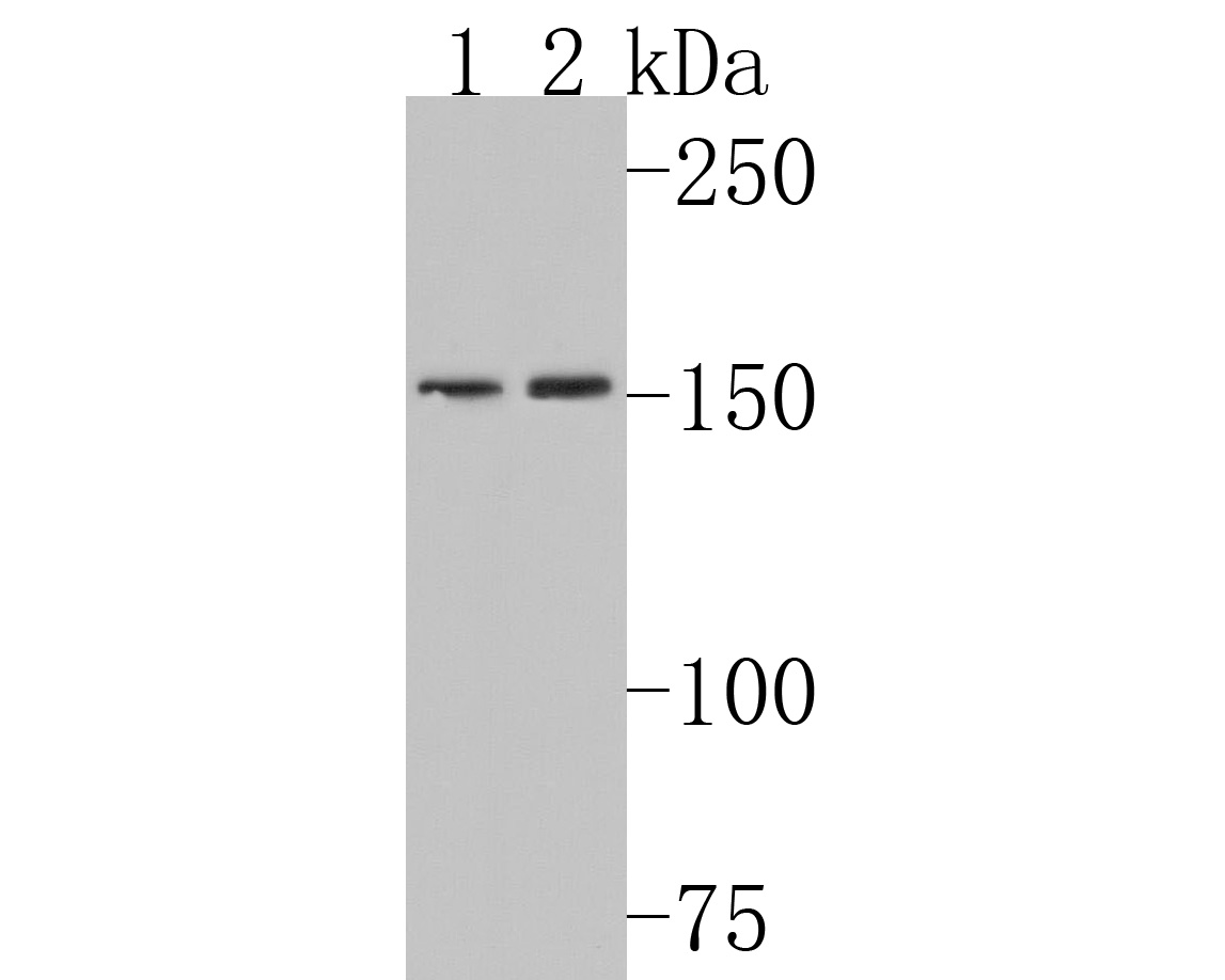 Western blot analysis of Collagen IV on different lysates. Proteins were transferred to a PVDF membrane and blocked with 5% BSA in PBS for 1 hour at room temperature. The primary antibody (HA500197, 1/500) was used in 5% BSA at room temperature for 2 hours. Goat Anti-Rabbit IgG - HRP Secondary Antibody (HA1001) at 1:200,000 dilution was used for 1 hour at room temperature.<br />
Positive control: <br />
Lane 1: MCF-7 cell lysate<br />
Lane 2: SH-SY5Y cell lysate