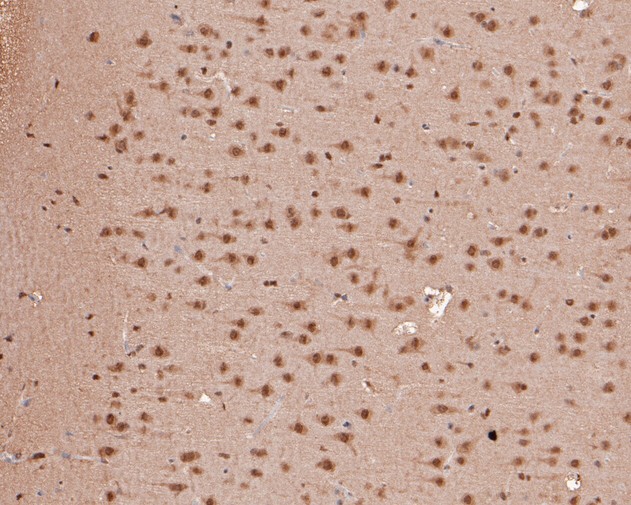 Immunohistochemical analysis of paraffin-embedded rat brain tissue using anti-Zic2 antibody. The section was pre-treated using heat mediated antigen retrieval with sodium citrate buffer (pH 6.0) for 20 minutes. The tissues were blocked in 5% BSA for 30 minutes at room temperature, washed with ddH2O and PBS, and then probed with the primary antibody (HA500195, 1/400)  for 30 minutes at room temperature. The detection was performed using an HRP conjugated compact polymer system. DAB was used as the chromogen. Tissues were counterstained with hematoxylin and mounted with DPX.
