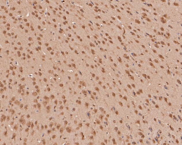 Immunohistochemical analysis of paraffin-embedded mouse brain tissue using anti-Zic2 antibody. The section was pre-treated using heat mediated antigen retrieval with sodium citrate buffer (pH 6.0) for 20 minutes. The tissues were blocked in 5% BSA for 30 minutes at room temperature, washed with ddH2O and PBS, and then probed with the primary antibody (HA500195, 1/400)  for 30 minutes at room temperature. The detection was performed using an HRP conjugated compact polymer system. DAB was used as the chromogen. Tissues were counterstained with hematoxylin and mounted with DPX.