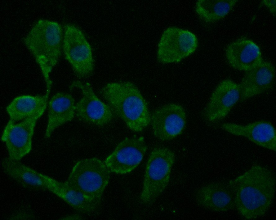 ICC staining of Wnt3a in SKOV-3 cells (green). Formalin fixed cells were permeabilized with 0.1% Triton X-100 in TBS for 10 minutes at room temperature and blocked with 1% Blocker BSA for 15 minutes at room temperature. Cells were probed with the primary antibody (HA500193, 1/50) for 1 hour at room temperature, washed with PBS. Alexa Fluor®488 Goat anti-Rabbit IgG was used as the secondary antibody at 1/1,000 dilution. The nuclear counter stain is DAPI (blue).