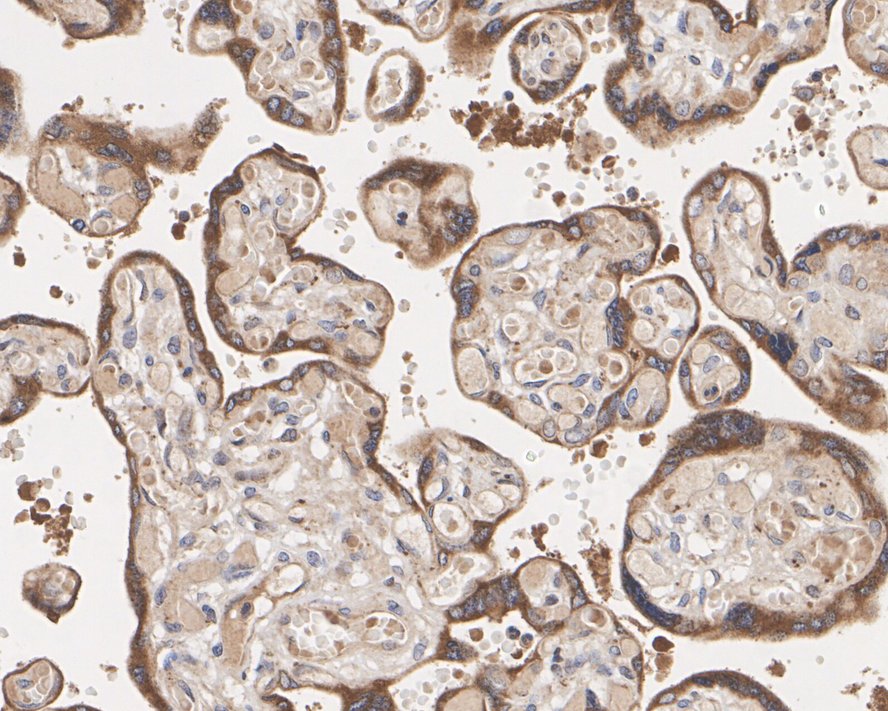 Immunohistochemical analysis of paraffin-embedded human thyroid tissue using anti-Wnt3a antibody. The section was pre-treated using heat mediated antigen retrieval with Tris-EDTA buffer (pH 8.0-8.4) for 20 minutes.The tissues were blocked in 5% BSA for 30 minutes at room temperature, washed with ddH2O and PBS, and then probed with the primary antibody (HA500193, 1/400) for 30 minutes at room temperature. The detection was performed using an HRP conjugated compact polymer system. DAB was used as the chromogen. Tissues were counterstained with hematoxylin and mounted with DPX.