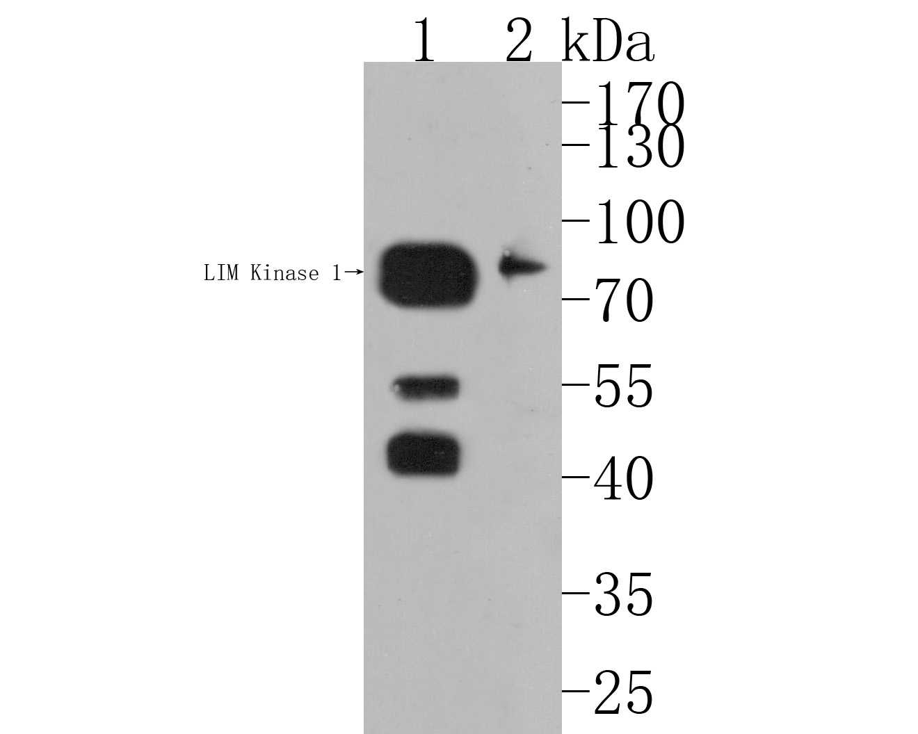 Western blot analysis of LIM Kinase 1 on different lysates. Proteins were transferred to a PVDF membrane and blocked with 5% BSA in PBS for 1 hour at room temperature. The primary antibody (HA500189, 1/500) was used in 5% BSA at room temperature for 2 hours. Goat Anti-Rabbit IgG - HRP Secondary Antibody (HA1001) at 1:200,000 dilution was used for 1 hour at room temperature.<br />
Positive control: <br />
Lane 1: Mouse lung tissue lysate<br />
Lane 2: Rat stomach tissue lysate