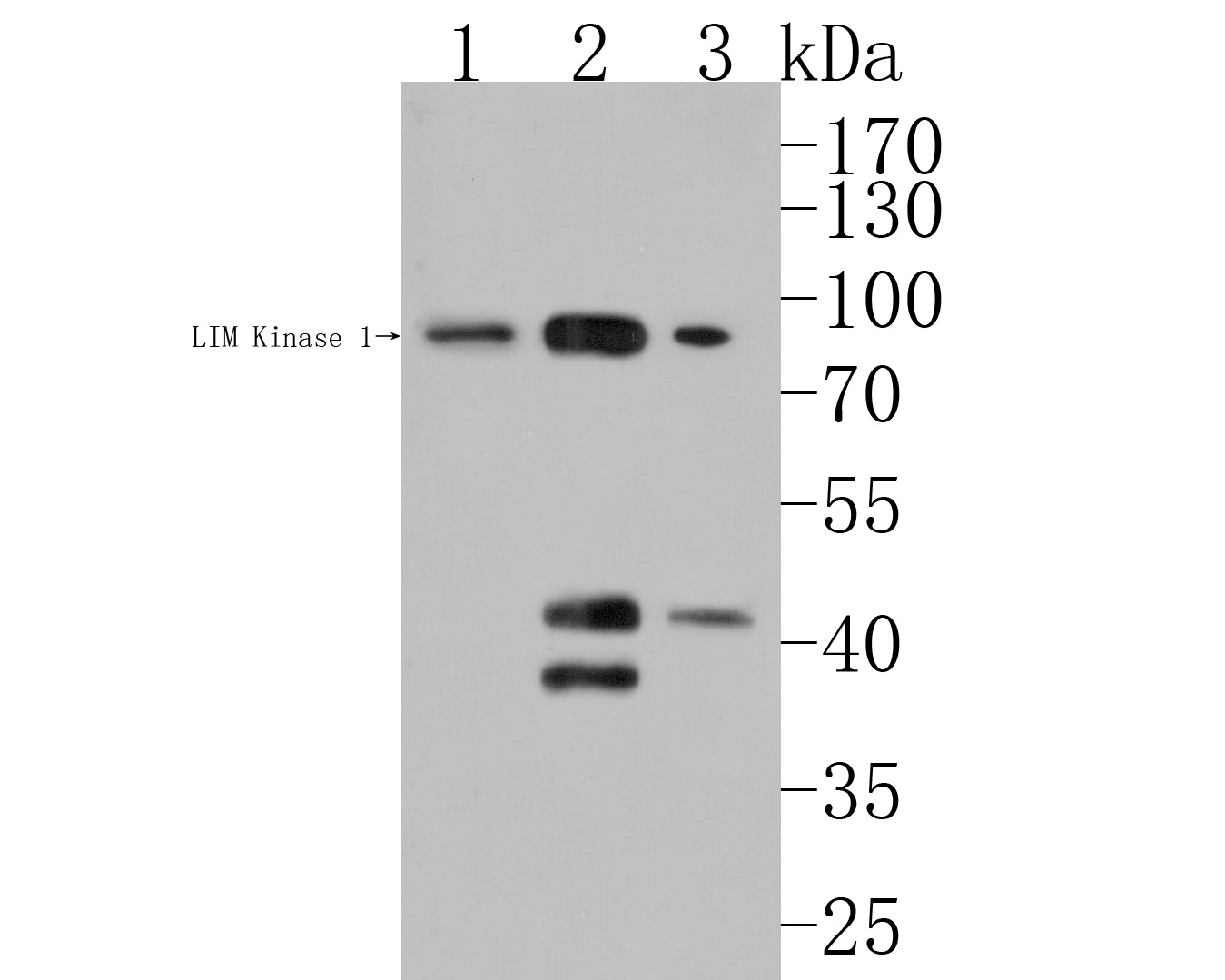 Western blot analysis of LIM Kinase 1 on different lysates. Proteins were transferred to a PVDF membrane and blocked with 5% BSA in PBS for 1 hour at room temperature. The primary antibody (HA500189, 1/1,000) was used in 5% BSA at room temperature for 2 hours. Goat Anti-Rabbit IgG - HRP Secondary Antibody (HA1001) at 1:200,000 dilution was used for 1 hour at room temperature.<br />
Positive control: <br />
Lane 1: Rat brain tissue lysate<br />
Lane 2: Rat heart tissue lysate<br />
Lane 3: Rat skeletal muscle tissue lysate