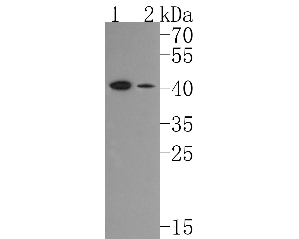 Western blot analysis of Inhibin alpha on different lysates. Proteins were transferred to a PVDF membrane and blocked with 5% BSA in PBS for 1 hour at room temperature. The primary antibody (HA500185, 1/500) was used in 5% BSA at room temperature for 2 hours. Goat Anti-Rabbit IgG - HRP Secondary Antibody (HA1001) at 1:200,000 dilution was used for 1 hour at room temperature.<br />
Positive control: <br />
Lane 1: Rat testis tissue lysate<br />
Lane 2: HepG2 cell lysate