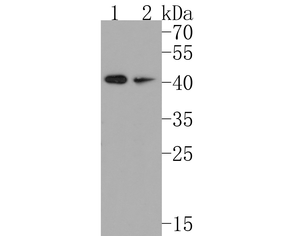 Western blot analysis of Inhibin alpha on different lysates. Proteins were transferred to a PVDF membrane and blocked with 5% BSA in PBS for 1 hour at room temperature. The primary antibody (HA500185, 1/500) was used in 5% BSA at room temperature for 2 hours. Goat Anti-Rabbit IgG - HRP Secondary Antibody (HA1001) at 1:200,000 dilution was used for 1 hour at room temperature.<br />
Positive control: <br />
Lane 1: Mouse testis tissue lysate<br />
Lane 2: PANC-1 cell lysate