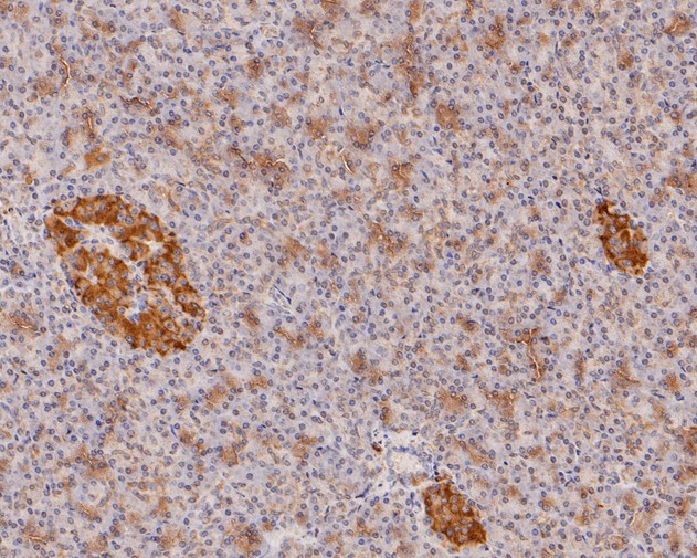 Immunohistochemical analysis of paraffin-embedded human pancreas tissue using anti-IL-32 antibody. The section was pre-treated using heat mediated antigen retrieval with Tris-EDTA buffer (pH 9.0) for 20 minutes.The tissues were blocked in 5% BSA for 30 minutes at room temperature, washed with ddH2O and PBS, and then probed with the primary antibody (HA500179, 1/1,500) for 30 minutes at room temperature. The detection was performed using an HRP conjugated compact polymer system. DAB was used as the chromogen. Tissues were counterstained with hematoxylin and mounted with DPX.