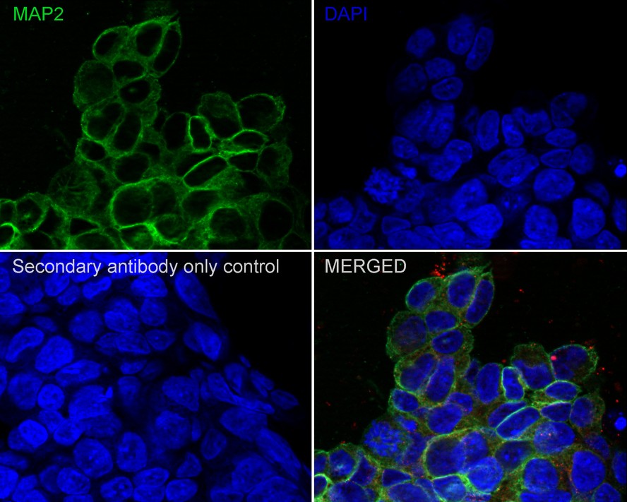 ICC staining of MAP2 in SH-SY5Y cells (green). Formalin fixed cells were permeabilized with 0.1% Triton X-100 in TBS for 10 minutes at room temperature and blocked with 10% negative goat serum for 15 minutes at room temperature. Cells were probed with the primary antibody (HA500177, 1/50) for 1 hour at room temperature, washed with PBS. Alexa Fluor®488 conjugate-Goat anti-Rabbit IgG was used as the secondary antibody at 1/1,000 dilution. The nuclear counter stain is DAPI (blue).