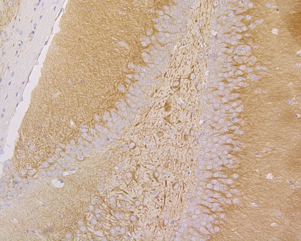 Immunohistochemical analysis of paraffin-embedded mouse brain tissue using anti-MAP2 antibody. The section was pre-treated using heat mediated antigen retrieval with Tris-EDTA buffer (pH 8.0-8.4) for 20 minutes.The tissues were blocked in 5% BSA for 30 minutes at room temperature, washed with ddH2O and PBS, and then probed with the primary antibody (HA500177, 1/800) for 30 minutes at room temperature. The detection was performed using an HRP conjugated compact polymer system. DAB was used as the chromogen. Tissues were counterstained with hematoxylin and mounted with DPX.