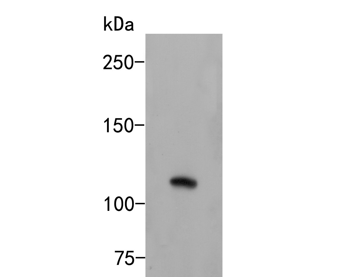 Western blot analysis of EVI1 on 293 cell lysates. Proteins were transferred to a PVDF membrane and blocked with 5% BSA in PBS for 1 hour at room temperature. The primary antibody (HA500173, 1/500) was used in 5% BSA at room temperature for 2 hours. Goat Anti-Rabbit IgG - HRP Secondary Antibody (HA1001) at 1:5,000 dilution was used for 1 hour at room temperature.