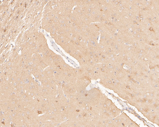 Immunohistochemical analysis of paraffin-embedded rat brain tissue using anti-COX5B antibody. The section was pre-treated using heat mediated antigen retrieval with Tris-EDTA buffer (pH 8.0-8.4) for 20 minutes.The tissues were blocked in 5% BSA for 30 minutes at room temperature, washed with ddH2O and PBS, and then probed with the primary antibody (HA500163, 1/200) for 30 minutes at room temperature. The detection was performed using an HRP conjugated compact polymer system. DAB was used as the chromogen. Tissues were counterstained with hematoxylin and mounted with DPX.