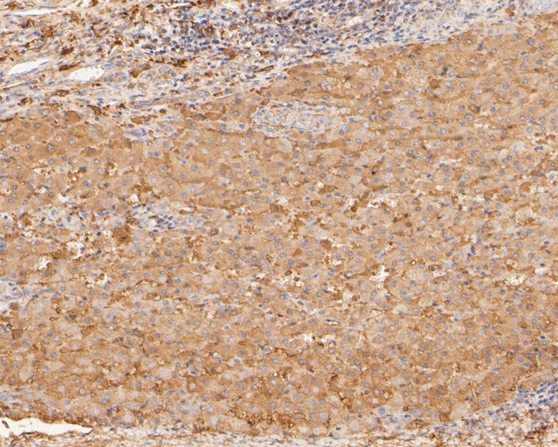 Immunohistochemical analysis of paraffin-embedded human liver tissue using anti-COX5B antibody. The section was pre-treated using heat mediated antigen retrieval with Tris-EDTA buffer (pH 8.0-8.4) for 20 minutes.The tissues were blocked in 5% BSA for 30 minutes at room temperature, washed with ddH2O and PBS, and then probed with the primary antibody (HA500163, 1/50) for 30 minutes at room temperature. The detection was performed using an HRP conjugated compact polymer system. DAB was used as the chromogen. Tissues were counterstained with hematoxylin and mounted with DPX.