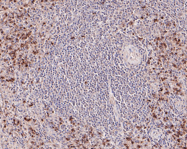 ICC staining of Granzyme B in MG-63 cells (green). Formalin fixed cells were permeabilized with 0.1% Triton X-100 in TBS for 10 minutes at room temperature and blocked with 1% Blocker BSA for 15 minutes at room temperature. Cells were probed with the primary antibody (HA500252, 1/200) for 1 hour at room temperature, washed with PBS. Alexa Fluor®488 Goat anti-Rabbit IgG was used as the secondary antibody at 1/1,000 dilution. The nuclear counter stain is DAPI (blue).