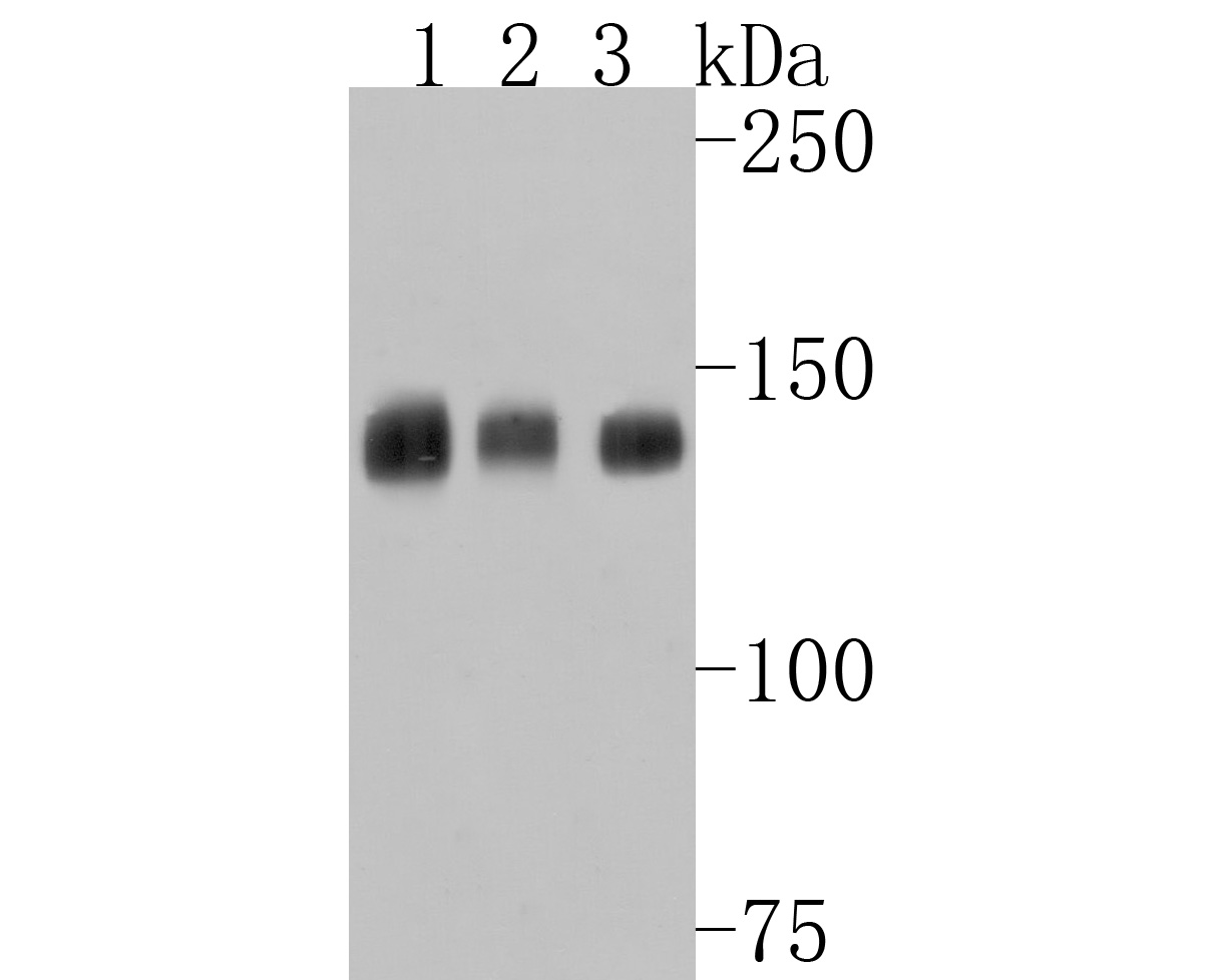 Western blot analysis of Hamartin on different lysates. Proteins were transferred to a PVDF membrane and blocked with 5% BSA in PBS for 1 hour at room temperature. The primary antibody (HA500199, 1/1,000) was used in 5% BSA at room temperature for 2 hours. Goat Anti-Rabbit IgG - HRP Secondary Antibody (HA1001) at 1:200,000 dilution was used for 1 hour at room temperature.<br />
Positive control: <br />
Lane 1: LO2 cell lysate<br />
Lane 2: 293 cell lysate<br />
Lane 3: A431 cell lysate