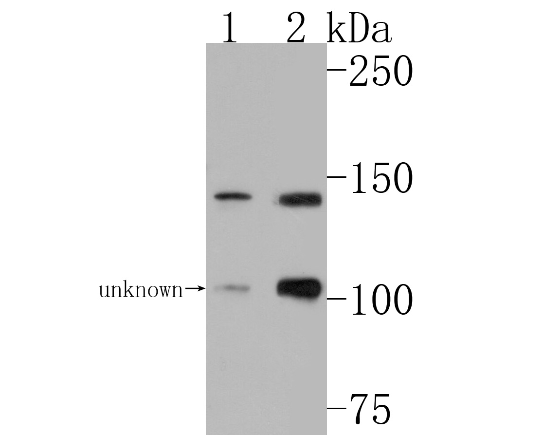 Western blot analysis of Hamartin on different lysates. Proteins were transferred to a PVDF membrane and blocked with 5% BSA in PBS for 1 hour at room temperature. The primary antibody (HA500199, 1/1,000) was used in 5% BSA at room temperature for 2 hours. Goat Anti-Rabbit IgG - HRP Secondary Antibody (HA1001) at 1:200,000 dilution was used for 1 hour at room temperature.<br />
Positive control: <br />
Lane 1: Mouse pancreas tissue lysate<br />
Lane 2: Rat brain tissue lysate