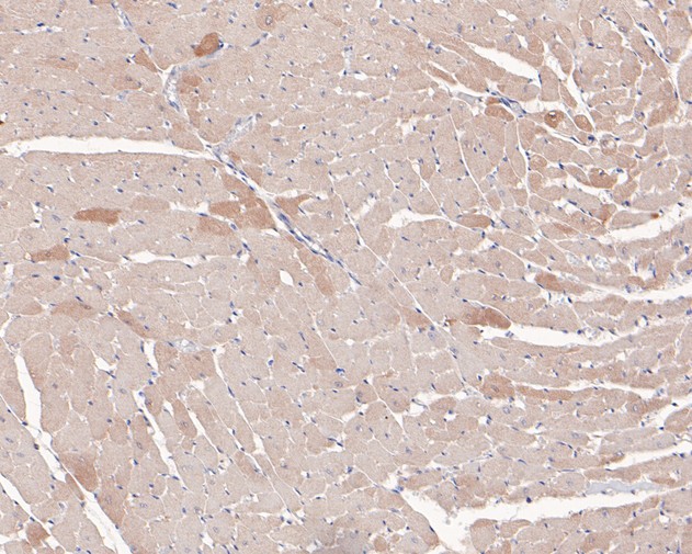 Immunohistochemical analysis of paraffin-embedded rat heart tissue using anti-Hamartin antibody. The section was pre-treated using heat mediated antigen retrieval with Tris-EDTA buffer (pH 9.0) for 20 minutes.The tissues were blocked in 5% BSA for 30 minutes at room temperature, washed with ddH2O and PBS, and then probed with the primary antibody (HA500199, 1/400) for 30 minutes at room temperature. The detection was performed using an HRP conjugated compact polymer system. DAB was used as the chromogen. Tissues were counterstained with hematoxylin and mounted with DPX.