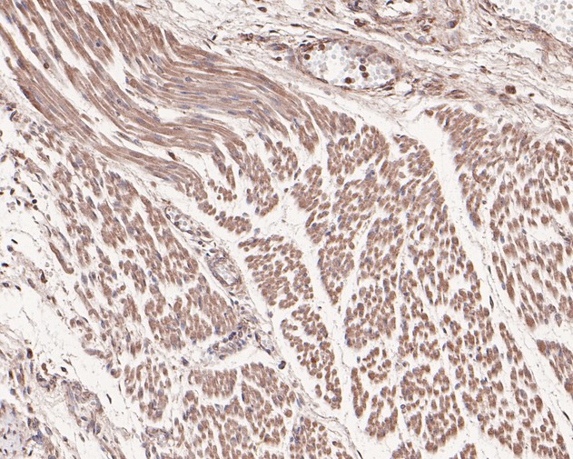 Immunohistochemical analysis of paraffin-embedded human fetal skeletal muscle tissue using anti-Hamartin antibody. The section was pre-treated using heat mediated antigen retrieval with Tris-EDTA buffer (pH 9.0) for 20 minutes.The tissues were blocked in 5% BSA for 30 minutes at room temperature, washed with ddH2O and PBS, and then probed with the primary antibody (HA500199, 1/100) for 30 minutes at room temperature. The detection was performed using an HRP conjugated compact polymer system. DAB was used as the chromogen. Tissues were counterstained with hematoxylin and mounted with DPX.