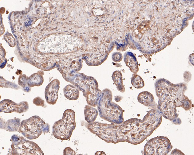 Immunohistochemical analysis of paraffin-embedded human placenta tissue using anti-Hamartin antibody. The section was pre-treated using heat mediated antigen retrieval with Tris-EDTA buffer (pH 9.0) for 20 minutes.The tissues were blocked in 5% BSA for 30 minutes at room temperature, washed with ddH2O and PBS, and then probed with the primary antibody (HA500199, 1/100) for 30 minutes at room temperature. The detection was performed using an HRP conjugated compact polymer system. DAB was used as the chromogen. Tissues were counterstained with hematoxylin and mounted with DPX.