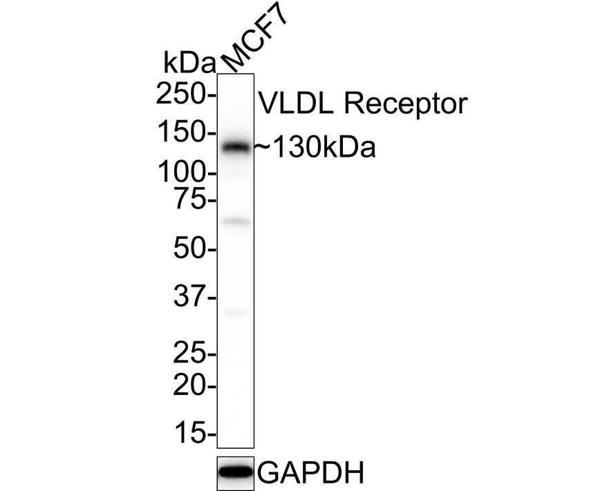 Western blot analysis of VLDL Receptor on MCF7 cell lysates with Rabbit anti-VLDL Receptor antibody (HA500194) at 1/1,000 dilution.<br />
<br />
Lysates/proteins at 30 µg/Lane.<br />
<br />
Predicted band size: 96 kDa<br />
Observed band size: 130 kDa<br />
<br />
Exposure time: 43 seconds;<br />
<br />
4-20% SDS-PAGE gel.<br />
<br />
Proteins were transferred to a PVDF membrane and blocked with 5% NFDM/TBST for 1 hour at room temperature. The primary antibody (HA500194) at 1/1,000 dilution was used in 5% NFDM/TBST at 4℃ overnight. Goat Anti-Rabbit IgG - HRP Secondary Antibody (HA1001) at 1/50,000 dilution was used for 1 hour at room temperature.