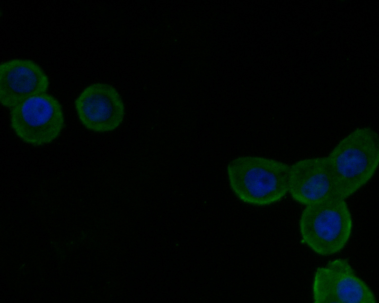 ICC staining of VLDL Receptor in LOVO cells (green). Formalin fixed cells were permeabilized with 0.1% Triton X-100 in TBS for 10 minutes at room temperature and blocked with 10% negative goat serum for 15 minutes at room temperature. Cells were probed with the primary antibody (HA500194, 1/50) for 1 hour at room temperature, washed with PBS. Alexa Fluor®488 conjugate-Goat anti-Rabbit IgG was used as the secondary antibody at 1/1,000 dilution. The nuclear counter stain is DAPI (blue).