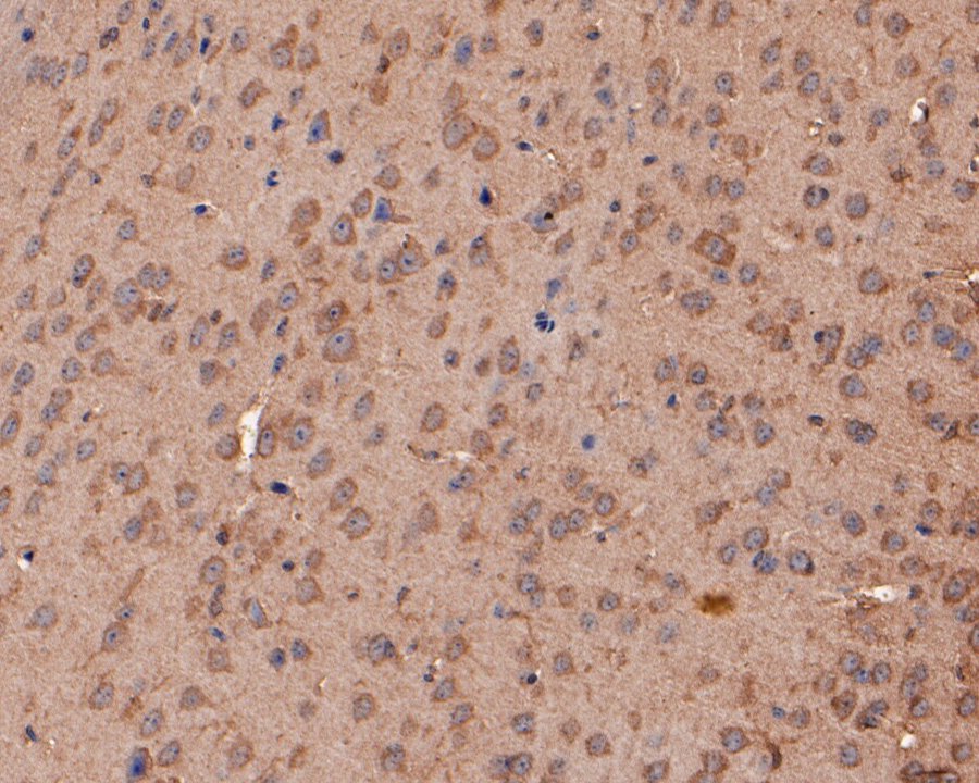 Immunohistochemical analysis of paraffin-embedded mouse brain tissue using anti-VLDL Receptor antibody. The section was pre-treated using heat mediated antigen retrieval with Tris-EDTA buffer (pH 9.0) for 20 minutes.The tissues were blocked in 5% BSA for 30 minutes at room temperature, washed with ddH2O and PBS, and then probed with the primary antibody (HA500194, 1/100) for 30 minutes at room temperature. The detection was performed using an HRP conjugated compact polymer system. DAB was used as the chromogen. Tissues were counterstained with hematoxylin and mounted with DPX.