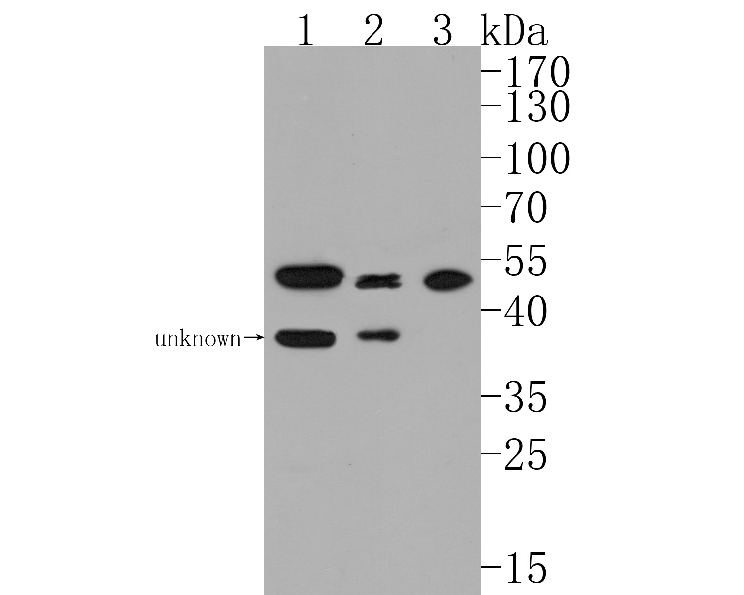 Western blot analysis of GABPA on different lysates. Proteins were transferred to a PVDF membrane and blocked with 5% BSA in PBS for 1 hour at room temperature. The primary antibody (HA500187, 1/500) was used in 5% BSA at room temperature for 2 hours. Goat Anti-Rabbit IgG - HRP Secondary Antibody (HA1001) at 1:5,000 dilution was used for 1 hour at room temperature.<br />
Positive control: <br />
Lane 1: A431 cell lysate<br />
Lane 2: Hela cell lysate<br />
Lane 3: 293T cell lysate