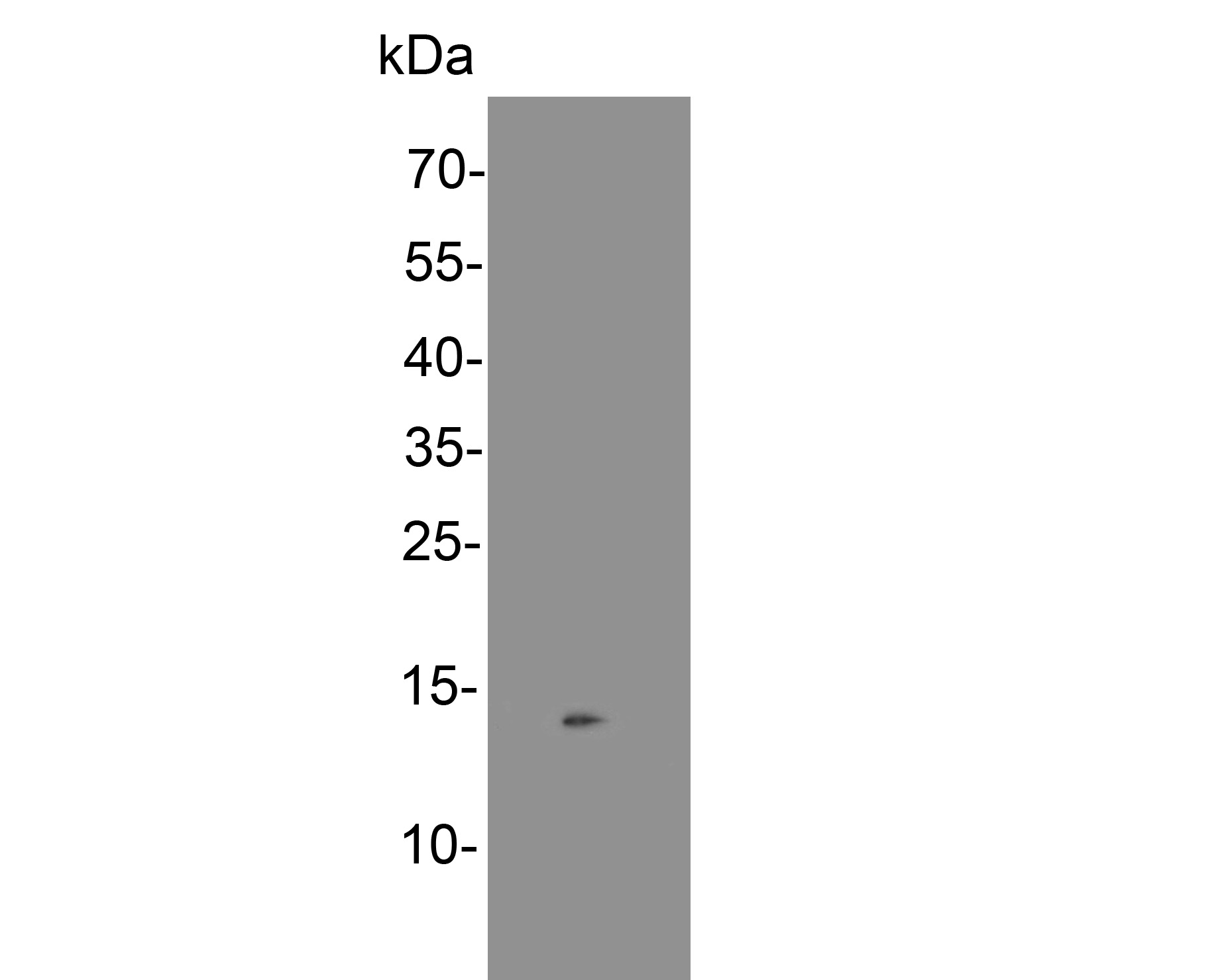 Western blot analysis of SNRPD3 on MCF-7 cell lysate. Proteins were transferred to a PVDF membrane and blocked with 5% NFDM/TBST for 1 hour at room temperature. The primary antibody (HA500254, 1/500) was used in 5% NFDM/TBST at room temperature for 2 hours. Goat Anti-Rabbit IgG - HRP Secondary Antibody (HA1001) at 1:200,000 dilution was used for 1 hour at room temperature.