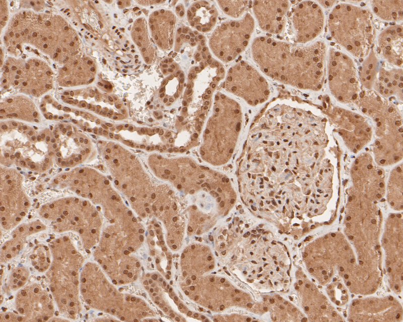 Immunohistochemical analysis of paraffin-embedded human kidney tissue using anti-SNRPD3 antibody. The section was pre-treated using heat mediated antigen retrieval with sodium citrate buffer (pH 6.0) for 20 minutes. The tissues were blocked in 5% BSA for 30 minutes at room temperature, washed with ddH2O and PBS, and then probed with the primary antibody (HA500254, 1/100)  for 30 minutes at room temperature. The detection was performed using an HRP conjugated compact polymer system. DAB was used as the chromogen. Tissues were counterstained with hematoxylin and mounted with DPX.