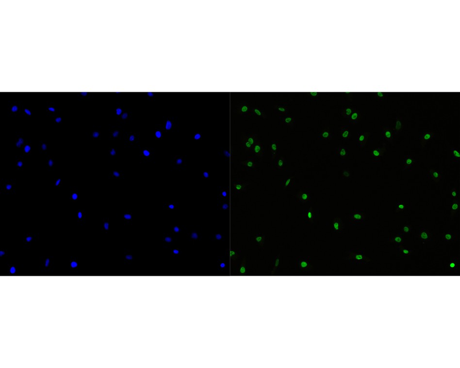 ICC staining of CDCA5 in A549 cells (green). Formalin fixed cells were permeabilized with 0.1% Triton X-100 in TBS for 10 minutes at room temperature and blocked with 1% Blocker BSA for 15 minutes at room temperature. Cells were probed with the primary antibody (HA720045, 1/50) for 1 hour at room temperature, washed with PBS. Alexa Fluor®488 Goat anti-Rabbit IgG was used as the secondary antibody at 1/1,000 dilution. The nuclear counter stain is DAPI (blue).