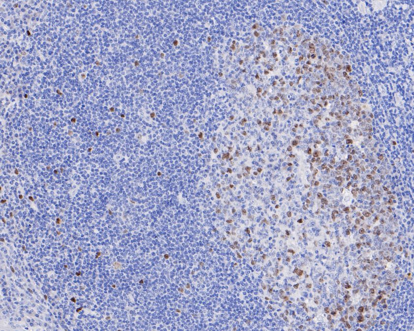 Immunohistochemical analysis of paraffin-embedded human tonsil tissue using anti-CDCA5 antibody. The section was pre-treated using heat mediated antigen retrieval with sodium citrate buffer (pH 6.0) for 20 minutes. The tissues were blocked in 5% BSA for 30 minutes at room temperature, washed with ddH2O and PBS, and then probed with the primary antibody (HA720045, 1/200)  for 30 minutes at room temperature. The detection was performed using an HRP conjugated compact polymer system. DAB was used as the chromogen. Tissues were counterstained with hematoxylin and mounted with DPX.