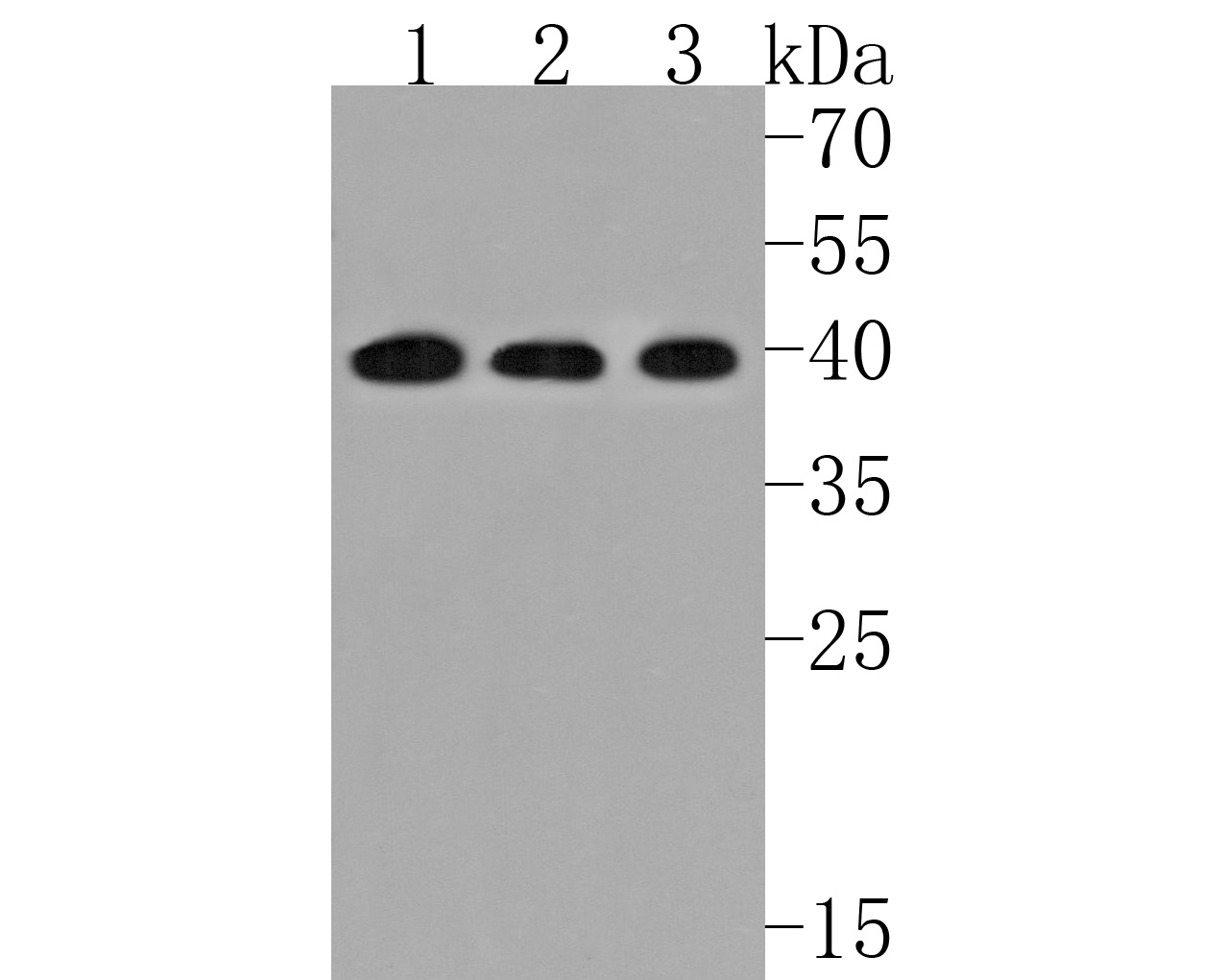 Western blot analysis of EDG2 on different lysates. Proteins were transferred to a PVDF membrane and blocked with 5% NFDM/TBST for 1 hour at room temperature. The primary antibody (HA720080, 1/500) was used in 5% NFDM/TBST at room temperature for 2 hours. Goat Anti-Rabbit IgG - HRP Secondary Antibody (HA1001) at 1:200,000 dilution was used for 1 hour at room temperature.<br />
Positive control: <br />
Lane 1: Jurkat cell lysate<br />
Lane 2: Hela cell lysate<br />
Lane 3: A549 cell lysate