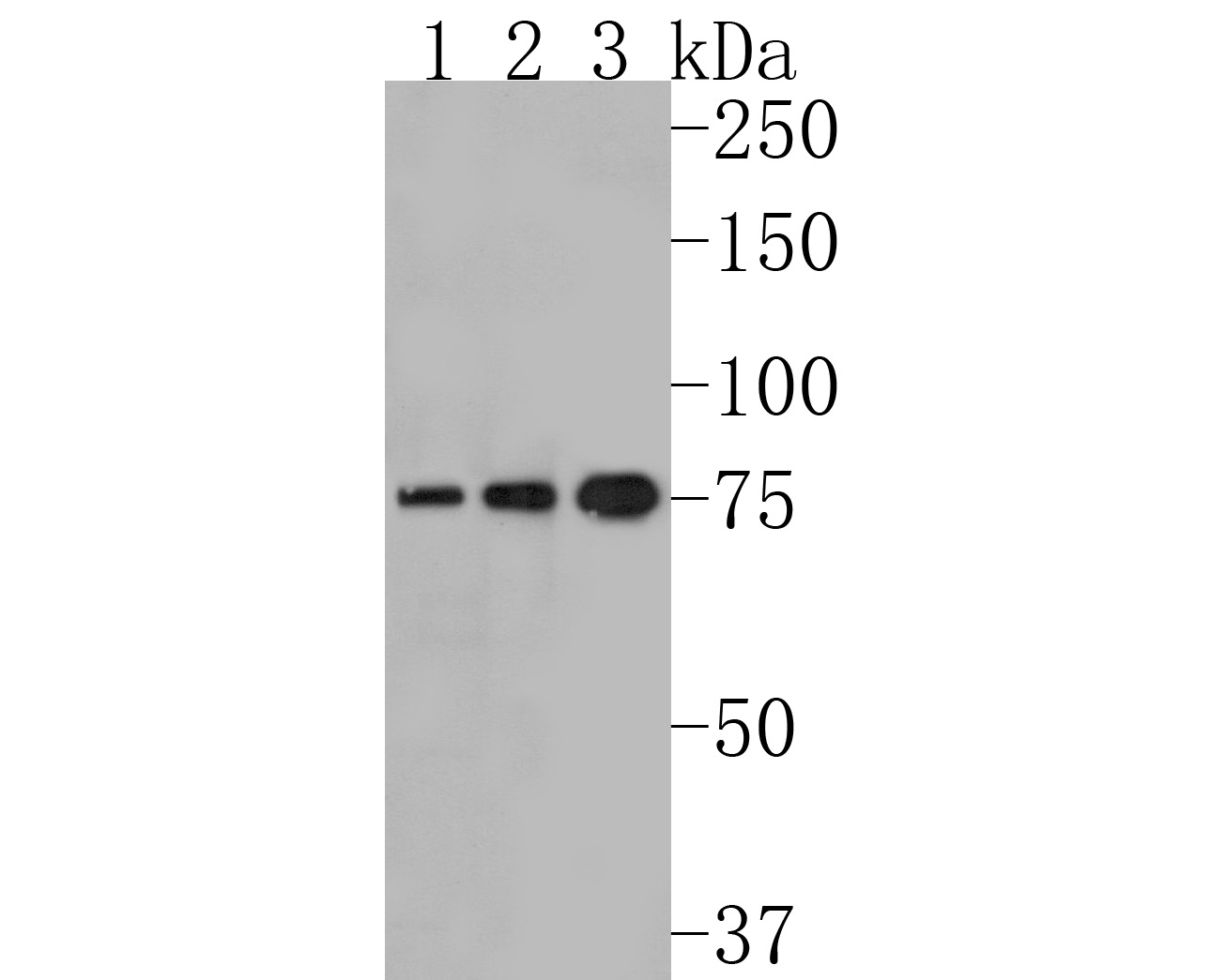 Western blot analysis of IRAK-1 on different lysates. Proteins were transferred to a PVDF membrane and blocked with 5% NFDM/TBST for 1 hour at room temperature. The primary antibody (HA720079, 1/500) was used in 5% NFDM/TBST at room temperature for 2 hours. Goat Anti-Rabbit IgG - HRP Secondary Antibody (HA1001) at 1:200,000 dilution was used for 1 hour at room temperature.<br />
Positive control: <br />
Lane 1: Hela cell lysate<br />
Lane 2: K562 cell lysate<br />
Lane 3: 293 cell lysate