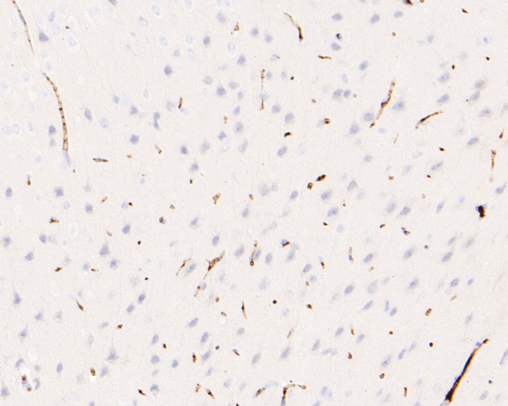 Immunohistochemical analysis of paraffin-embedded mouse brain tissue using anti-IRAK-1 antibody. The section was pre-treated using heat mediated antigen retrieval with Tris-EDTA buffer (pH 9.0) for 20 minutes.The tissues were blocked in 5% BSA for 30 minutes at room temperature, washed with ddH2O and PBS, and then probed with the primary antibody (HA720079, 1/200) for 30 minutes at room temperature. The detection was performed using an HRP conjugated compact polymer system. DAB was used as the chromogen. Tissues were counterstained with hematoxylin and mounted with DPX.