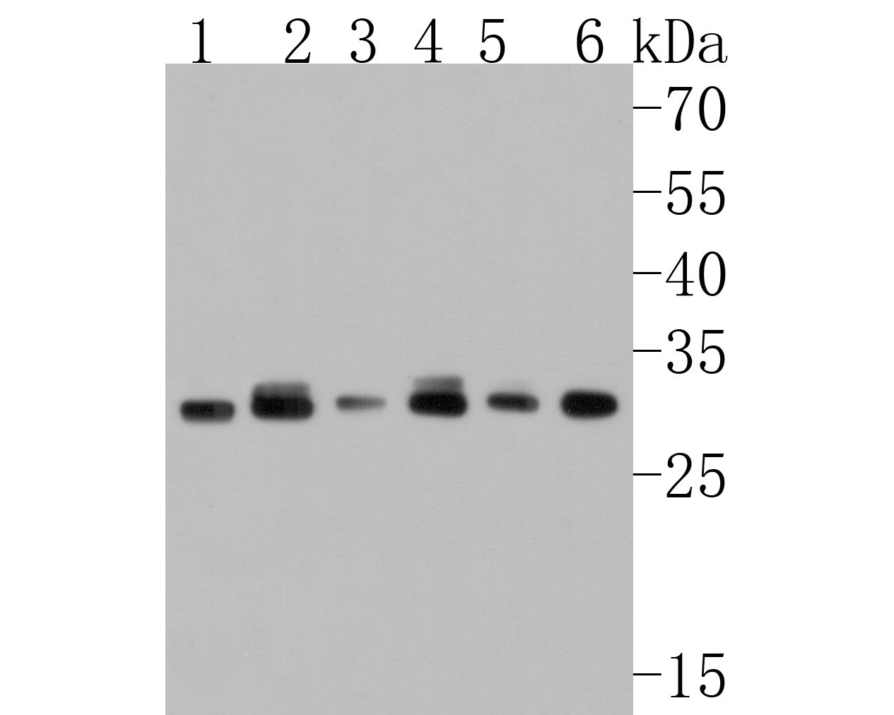 Western blot analysis of GC1q R on different lysates. Proteins were transferred to a PVDF membrane and blocked with 5% NFTM/TBSA for 1 hour at room temperature. The primary antibody (HA720078, 1/500) was used in 5% NFTM/TBSA at room temperature for 2 hours. Goat Anti-Rabbit IgG - HRP Secondary Antibody (HA1001) at 1:200,000 dilution was used for 1 hour at room temperature.<br />
Positive control: <br />
Lane 1: PC-12 cell lysate<br />
Lane 2: NIH/3T3 cell lysate<br />
Lane 3: RAW264.7 cell lysate<br />
Lane 4: Hela cell lysate<br />
Lane 5: A549 cell lysate<br />
Lane 6: Mouse spleen tissue lysate