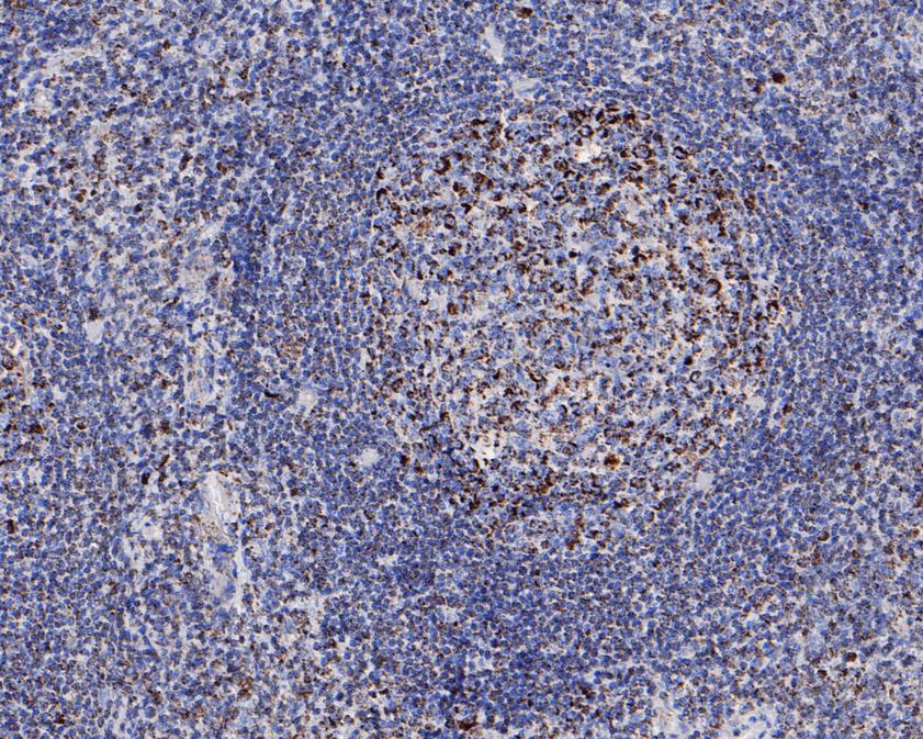 Immunohistochemical analysis of paraffin-embedded human tonsil tissue using anti-GC1q R antibody. The section was pre-treated using heat mediated antigen retrieval with sodium citrate buffer (pH 6.0) for 20 minutes. The tissues were blocked in 5% BSA for 30 minutes at room temperature, washed with ddH2O and PBS, and then probed with the primary antibody (HA720078, 1/50)  for 30 minutes at room temperature. The detection was performed using an HRP conjugated compact polymer system. DAB was used as the chromogen. Tissues were counterstained with hematoxylin and mounted with DPX.