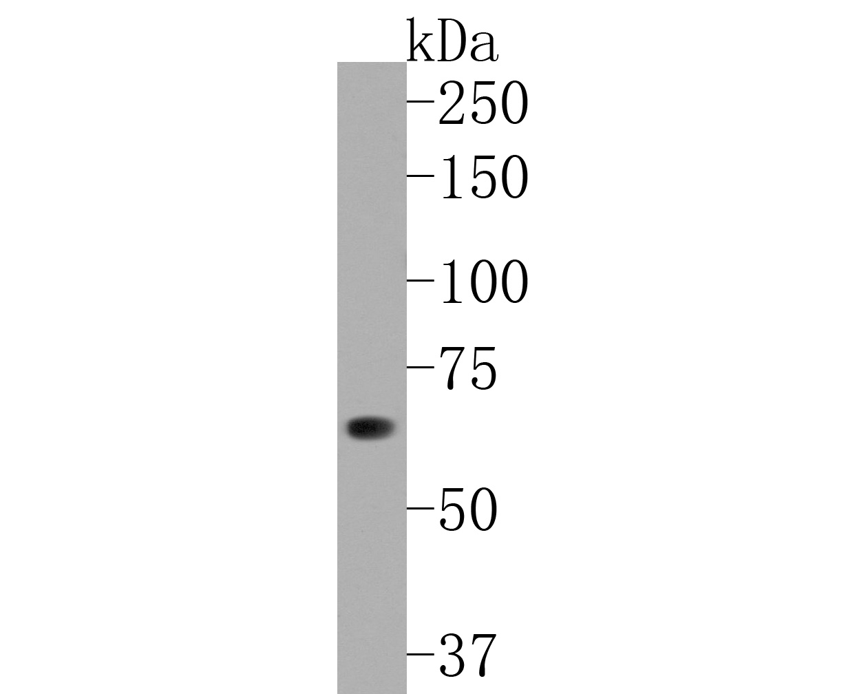 Western blot analysis of GBP1 on human small intestine tissue lysates. Proteins were transferred to a PVDF membrane and blocked with 5% NFDM/TBST for 1 hour at room temperature. The primary antibody (HA720049, 1/500) was used in 5% NFDM/TBST at room temperature for 2 hours. Goat Anti-Rabbit IgG - HRP Secondary Antibody (HA1001) at 1:200,000 dilution was used for 1 hour at room temperature.