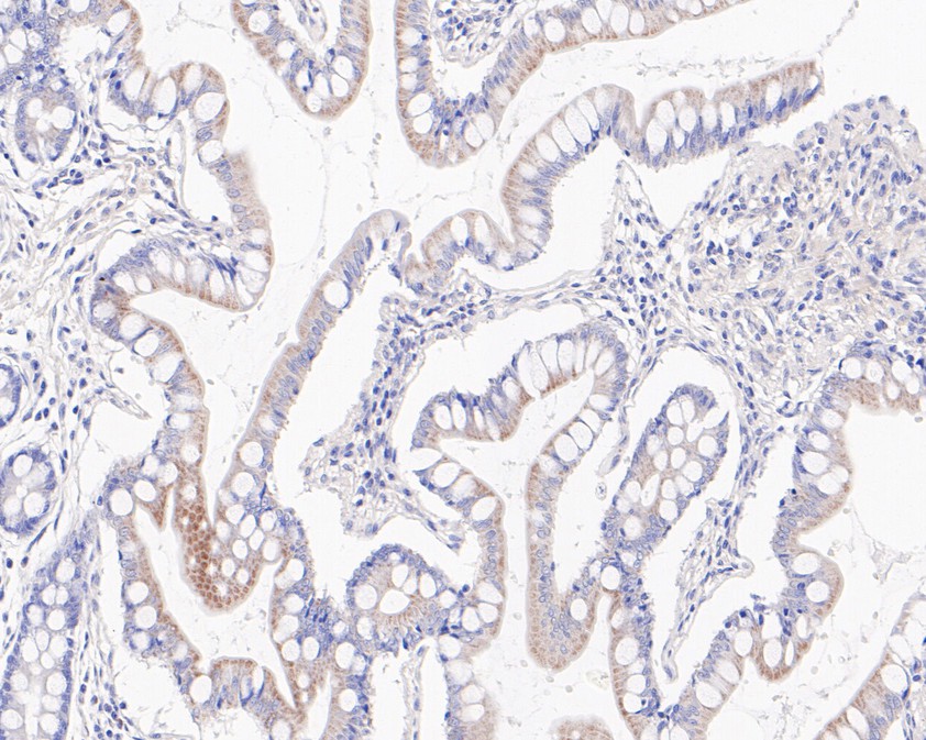 Immunohistochemical analysis of paraffin-embedded human small intestine tissue using anti-GBP1 antibody. The section was pre-treated using heat mediated antigen retrieval with Tris-EDTA buffer (pH 9.0) for 20 minutes.The tissues were blocked in 5% BSA for 30 minutes at room temperature, washed with ddH2O and PBS, and then probed with the primary antibody (HA720049, 1/50) for 30 minutes at room temperature. The detection was performed using an HRP conjugated compact polymer system. DAB was used as the chromogen. Tissues were counterstained with hematoxylin and mounted with DPX.