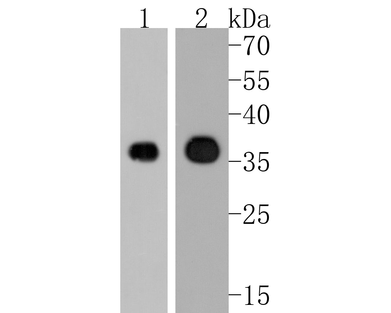Western blot analysis of PPP6C on different lysates. Proteins were transferred to a PVDF membrane and blocked with 5% NFDM/TBST for 1 hour at room temperature. The primary antibody (HA720056, 1/500) was used in 5% NFDM/TBST at room temperature for 2 hours. Goat Anti-Rabbit IgG - HRP Secondary Antibody (HA1001) at 1:200,000 dilution was used for 1 hour at room temperature.<br />
Positive control: <br />
Lane 1: Hela cell lysate<br />
Lane 2: Mouse spleen tissue lysate