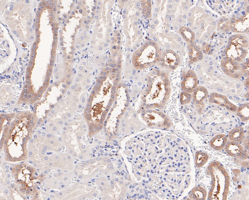 Immunohistochemical analysis of paraffin-embedded human kidney tissue using anti-PPP6C antibody. The section was pre-treated using heat mediated antigen retrieval with Tris-EDTA buffer (pH 9.0) for 20 minutes.The tissues were blocked in 5% BSA for 30 minutes at room temperature, washed with ddH2O and PBS, and then probed with the primary antibody (HA720056, 1/50) for 30 minutes at room temperature. The detection was performed using an HRP conjugated compact polymer system. DAB was used as the chromogen. Tissues were counterstained with hematoxylin and mounted with DPX.