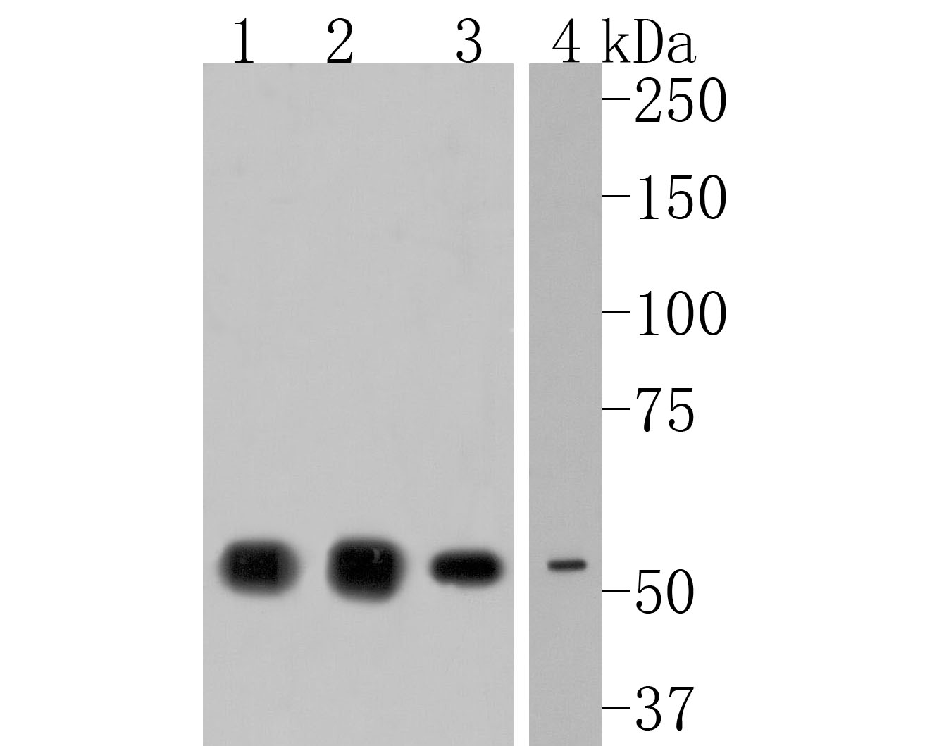 Western blot analysis of NPY5R on different lysates. Proteins were transferred to a PVDF membrane and blocked with 5% NFDM/TBST for 1 hour at room temperature. The primary antibody (HA720061, 1/500) was used in 5% NFDM/TBST at room temperature for 2 hours. Goat Anti-Rabbit IgG - HRP Secondary Antibody (HA1001) at 1:200,000 dilution was used for 1 hour at room temperature.<br />
Positive control: <br />
Lane 1: Human brain tissue lysate<br />
Lane 2: Rat brain tissue lysate<br />
Lane 3: A549 cell lysate<br />
Lane 4: Mouse spleen tissue lysate