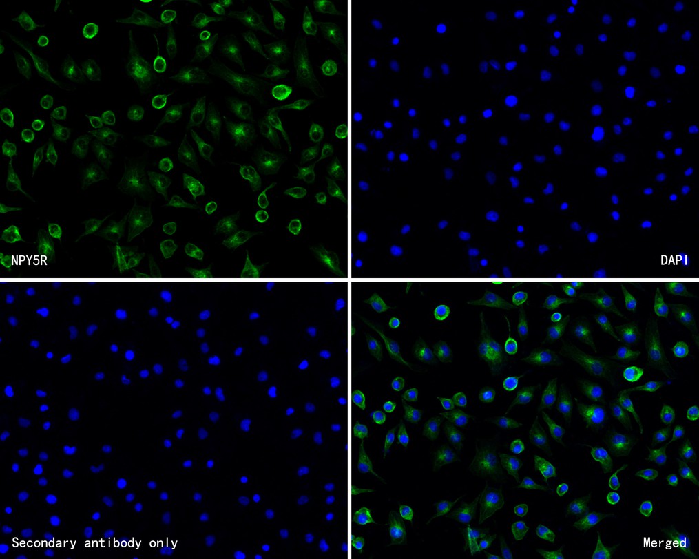 ICC staining of NPY5R in A549 cells (green). Formalin fixed cells were permeabilized with 0.1% Triton X-100 in TBS for 10 minutes at room temperature and blocked with 10% negative goat serum for 15 minutes at room temperature. Cells were probed with the primary antibody (HA720061, 1/200) for 1 hour at room temperature, washed with PBS. Alexa Fluor®488 Goat anti-Rabbit IgG was used as the secondary antibody at 1/1,000 dilution. The nuclear counter stain is DAPI (blue).