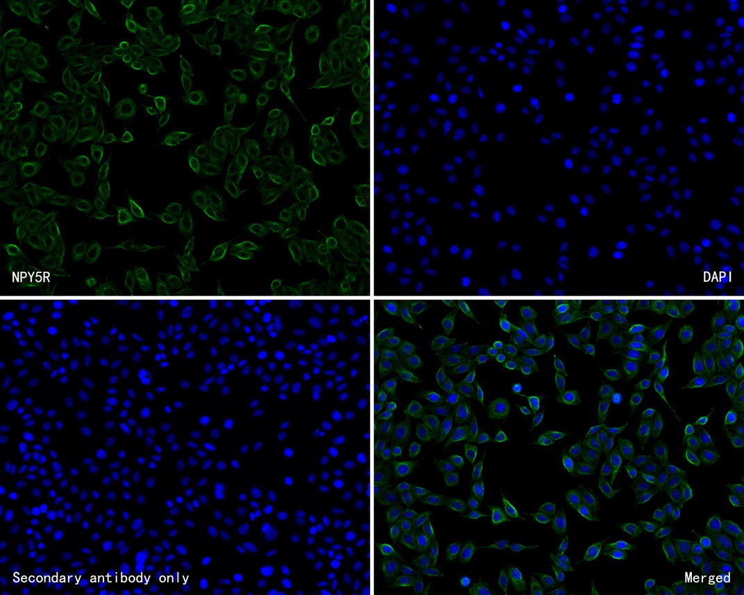 ICC staining of NPY5R in SiHa cells (green). Formalin fixed cells were permeabilized with 0.1% Triton X-100 in TBS for 10 minutes at room temperature and blocked with 10% negative goat serum for 15 minutes at room temperature. Cells were probed with the primary antibody (HA720061, 1/50) for 1 hour at room temperature, washed with PBS. Alexa Fluor®488 Goat anti-Rabbit IgG was used as the secondary antibody at 1/1,000 dilution. The nuclear counter stain is DAPI (blue).