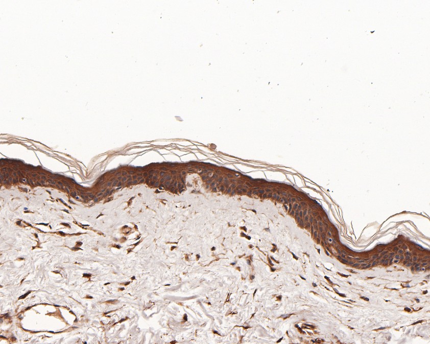 Immunohistochemical analysis of paraffin-embedded human skin tissue using anti-NPY5R antibody. The section was pre-treated using heat mediated antigen retrieval with Tris-EDTA buffer (pH 9.0) for 20 minutes.The tissues were blocked in 5% BSA for 30 minutes at room temperature, washed with ddH2O and PBS, and then probed with the primary antibody (HA720061, 1/50) for 30 minutes at room temperature. The detection was performed using an HRP conjugated compact polymer system. DAB was used as the chromogen. Tissues were counterstained with hematoxylin and mounted with DPX.