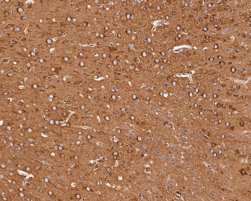 Immunohistochemical analysis of paraffin-embedded mouse brain tissue using anti-NPY5R antibody. The section was pre-treated using heat mediated antigen retrieval with Tris-EDTA buffer (pH 9.0) for 20 minutes.The tissues were blocked in 5% BSA for 30 minutes at room temperature, washed with ddH2O and PBS, and then probed with the primary antibody (HA720061, 1/50) for 30 minutes at room temperature. The detection was performed using an HRP conjugated compact polymer system. DAB was used as the chromogen. Tissues were counterstained with hematoxylin and mounted with DPX.