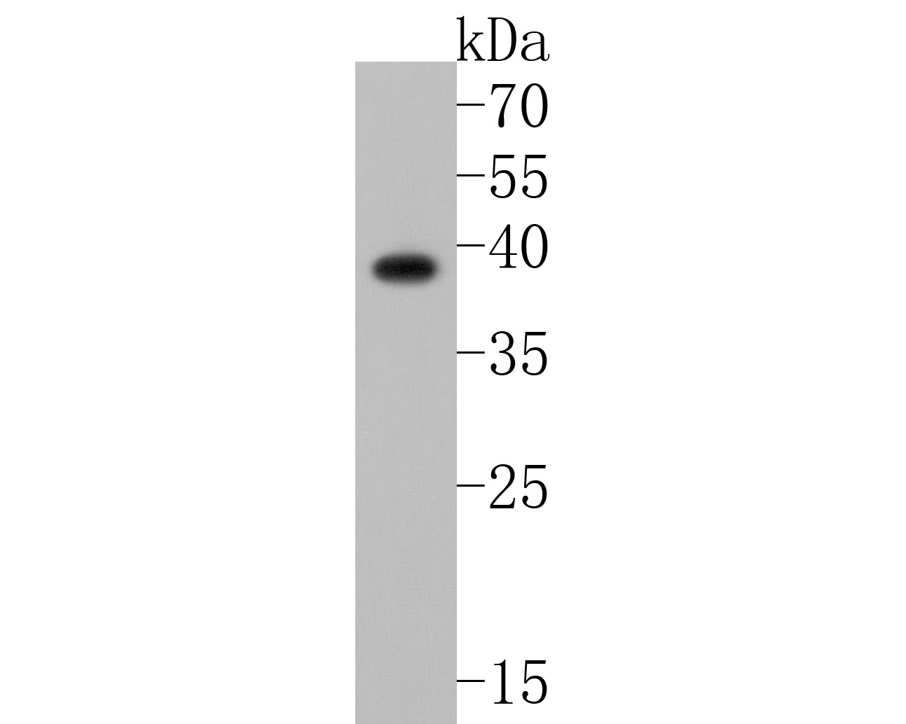Western blot analysis of MC-2 on SiHa cell lysates. Proteins were transferred to a PVDF membrane and blocked with 5% NFDM/TBST for 1 hour at room temperature. The primary antibody (HA720055, 1/500) was used in 5% NFDM/TBST at room temperature for 2 hours. Goat Anti-Rabbit IgG - HRP Secondary Antibody (HA1001) at 1:200,000 dilution was used for 1 hour at room temperature.
