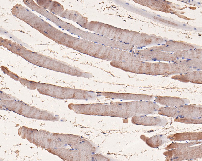 Immunohistochemical analysis of paraffin-embedded mouse skeletal muscle tissue using anti-ORP1 antibody. The section was pre-treated using heat mediated antigen retrieval with Tris-EDTA buffer (pH 9.0) for 20 minutes.The tissues were blocked in 5% BSA for 30 minutes at room temperature, washed with ddH2O and PBS, and then probed with the primary antibody (HA720053, 1/50) for 30 minutes at room temperature. The detection was performed using an HRP conjugated compact polymer system. DAB was used as the chromogen. Tissues were counterstained with hematoxylin and mounted with DPX.