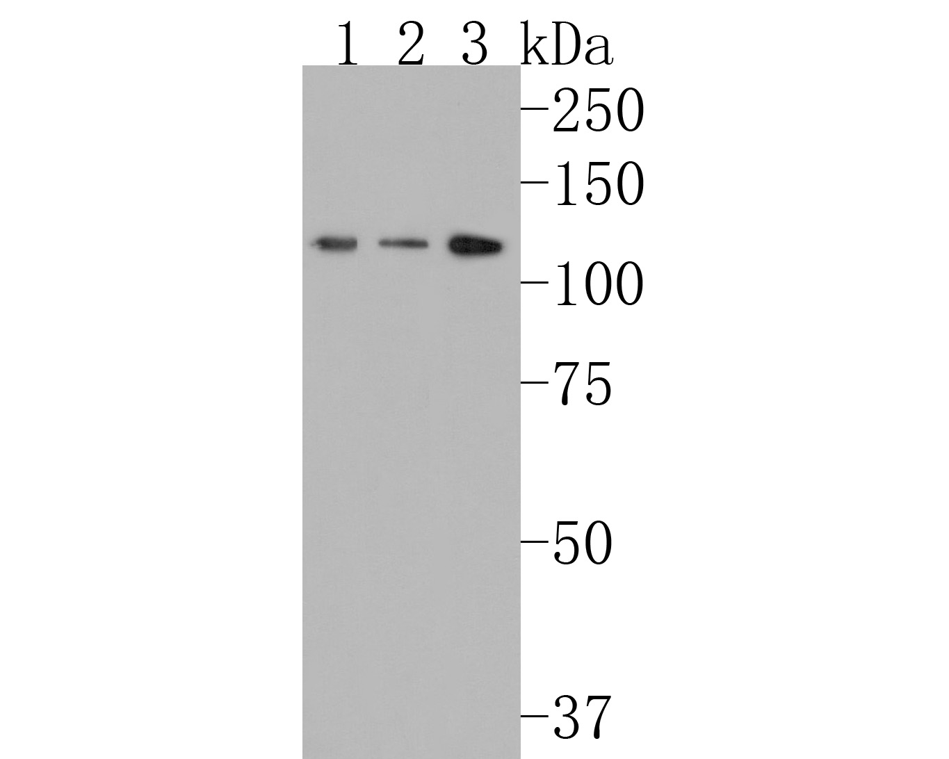 Western blot analysis of RASA1 on different lysates. Proteins were transferred to a PVDF membrane and blocked with 5% NFDM/TBST for 1 hour at room temperature. The primary antibody (HA720052, 1/500) was used in 5% NFDM/TBST at room temperature for 2 hours. Goat Anti-Rabbit IgG - HRP Secondary Antibody (HA1001) at 1:200,000 dilution was used for 1 hour at room temperature.<br />
Positive control: <br />
Lane 1: A431 cell lysate<br />
Lane 2: 293 cell lysate<br />
Lane 3: Mouse brain tissue lysate