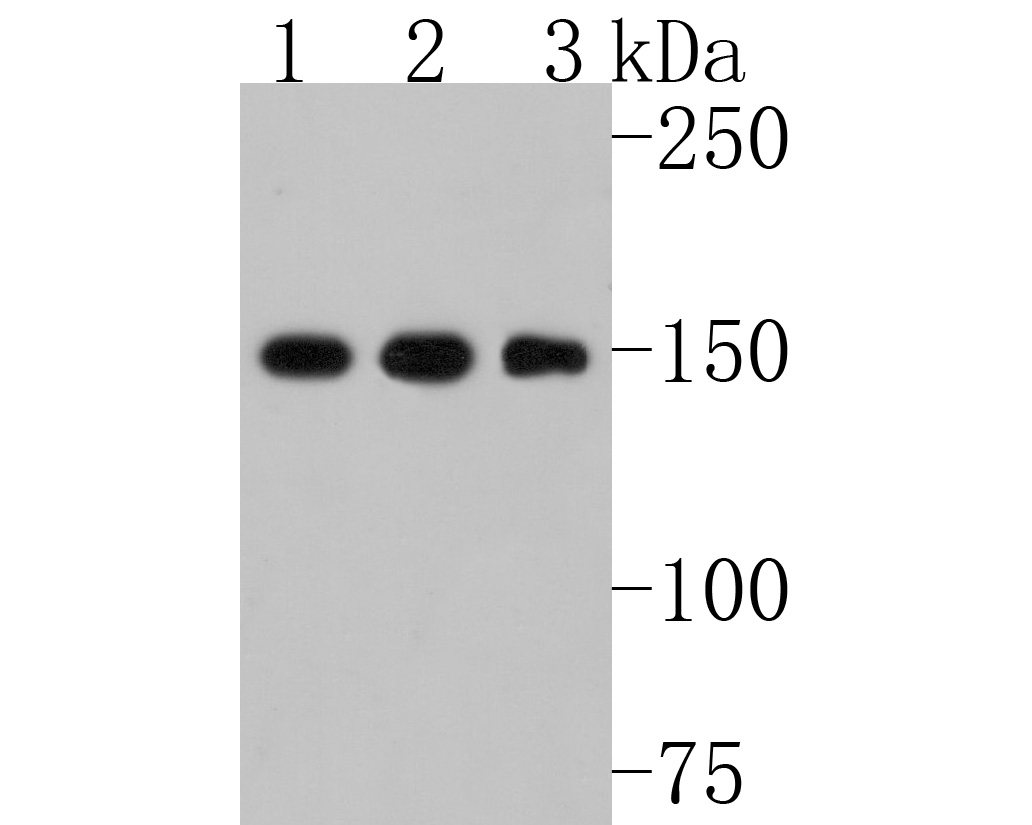 Western blot analysis of Collagen III on different lysates. Proteins were transferred to a PVDF membrane and blocked with 5% NFDM/TBST for 1 hour at room temperature. The primary antibody (HA720050, 1/500) was used in 5% NFDM/TBST at room temperature for 2 hours. Goat Anti-Rabbit IgG - HRP Secondary Antibody (HA1001) at 1:200,000 dilution was used for 1 hour at room temperature.<br />
Positive control: <br />
Lane 1: Hela cell lysate<br />
Lane 2: MCF-7 cell lysate<br />
Lane 3: A431 cell lysate